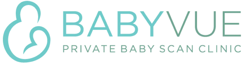 Babyvue